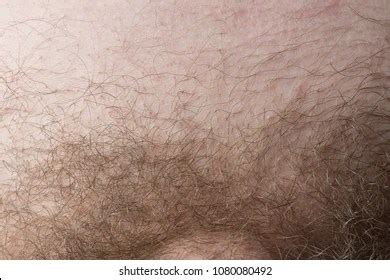 pubic hair wikipedia